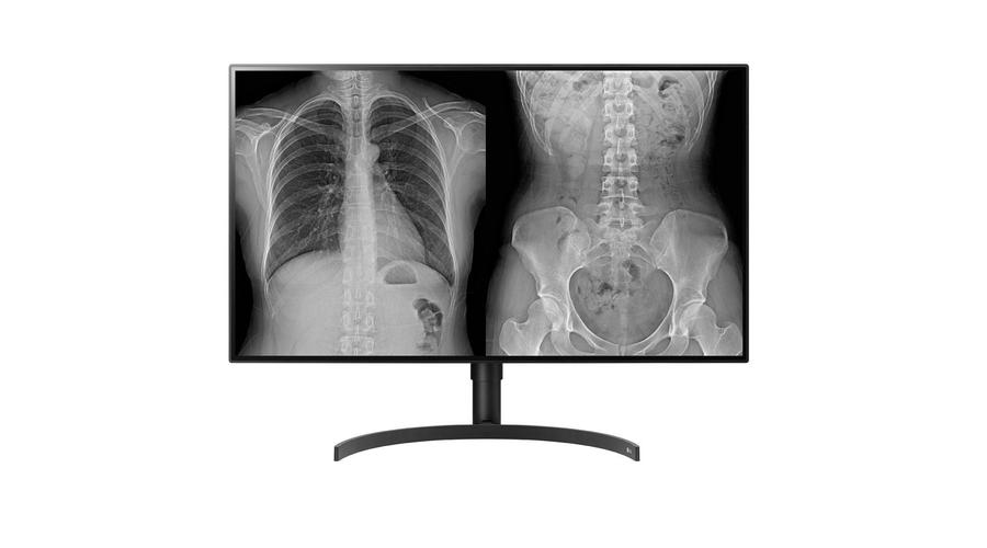 LG 32HL512D-B számítógép monitor 80 cm (31.5") 3840 x 2160 pixelek Full HD Fekete